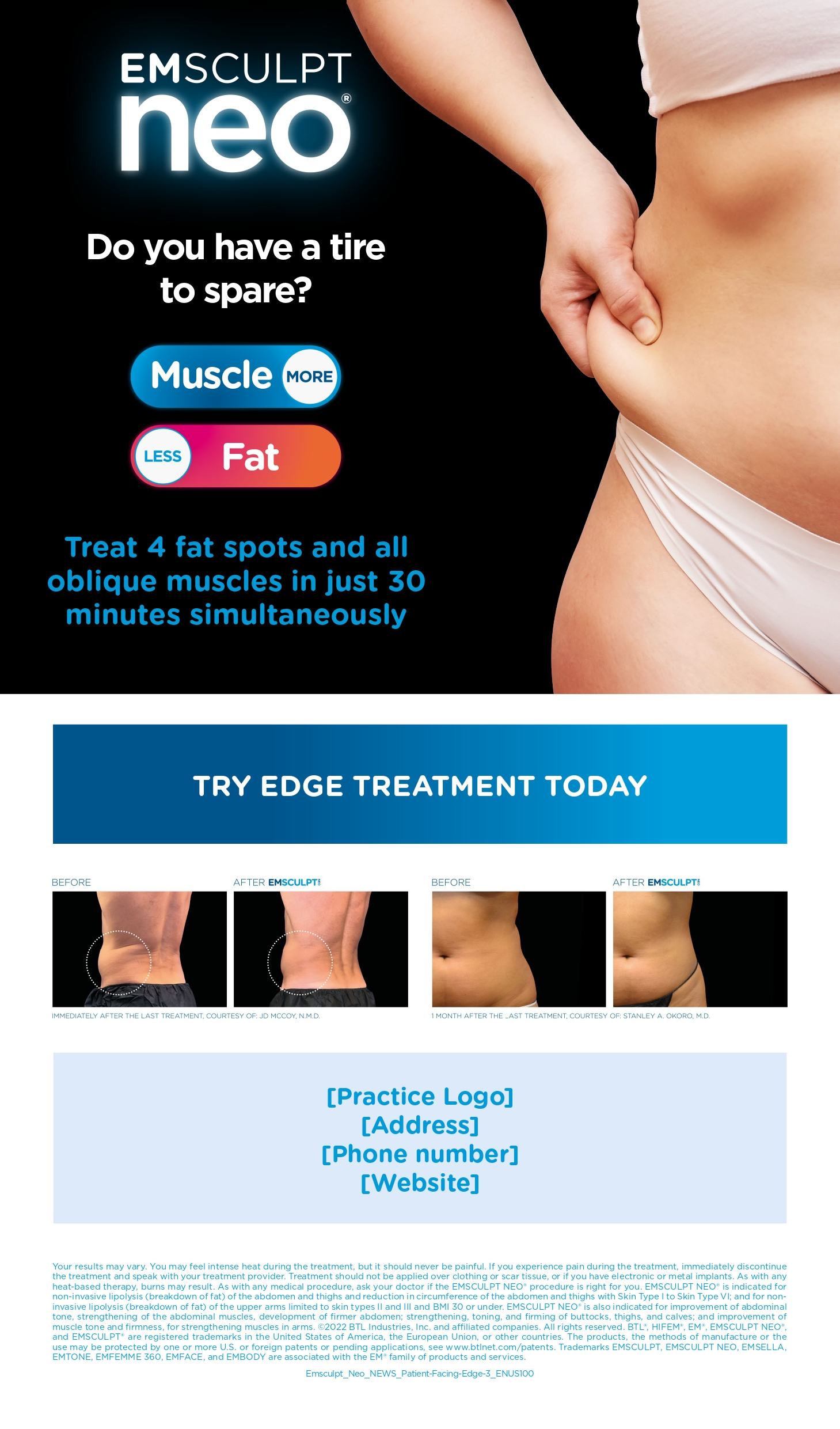 Emsculpt_Neo_NEWS_Patient-Facing-Edge-3_ENUS100_page-0001 (1) Emsculpt Neo